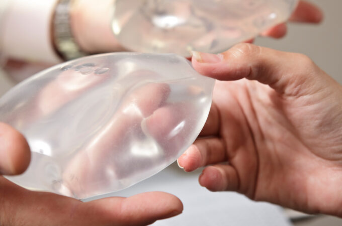 6 Compelling Reasons Not to Be Afraid or Guilty About Having Breast Implants