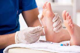 Are Plantar Warts Contagious After Treatment?