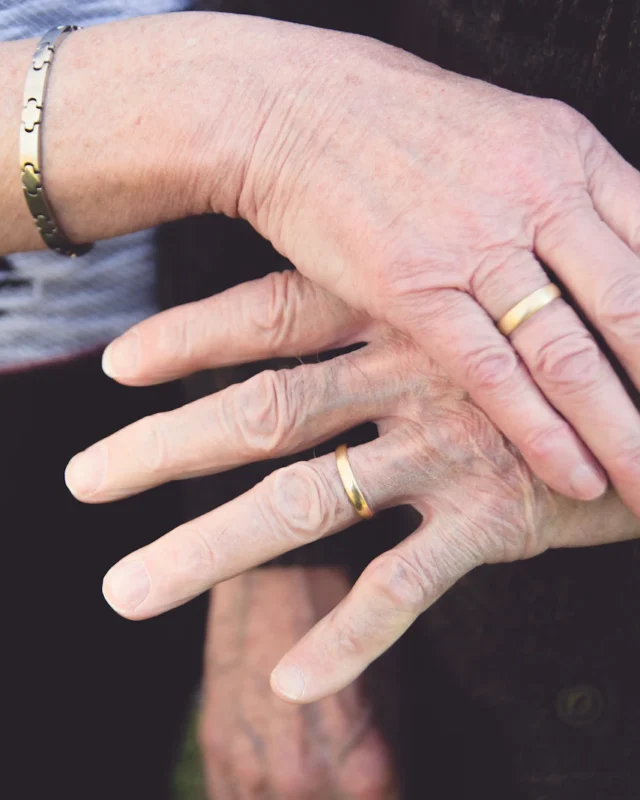 Why Does Jewelry Turn Your Skin Green? And How to Stop It