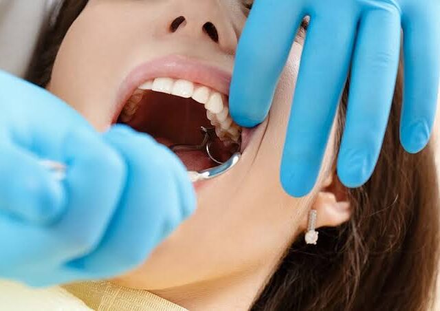 K -What College Students Should Know Before Wisdom Teeth Surgery