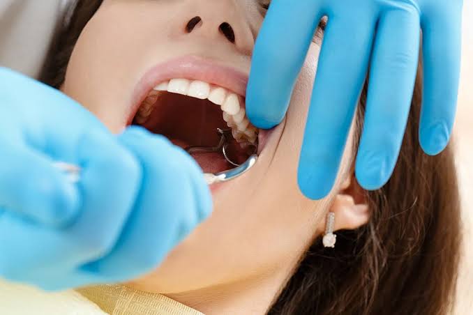K -What College Students Should Know Before Wisdom Teeth Surgery
