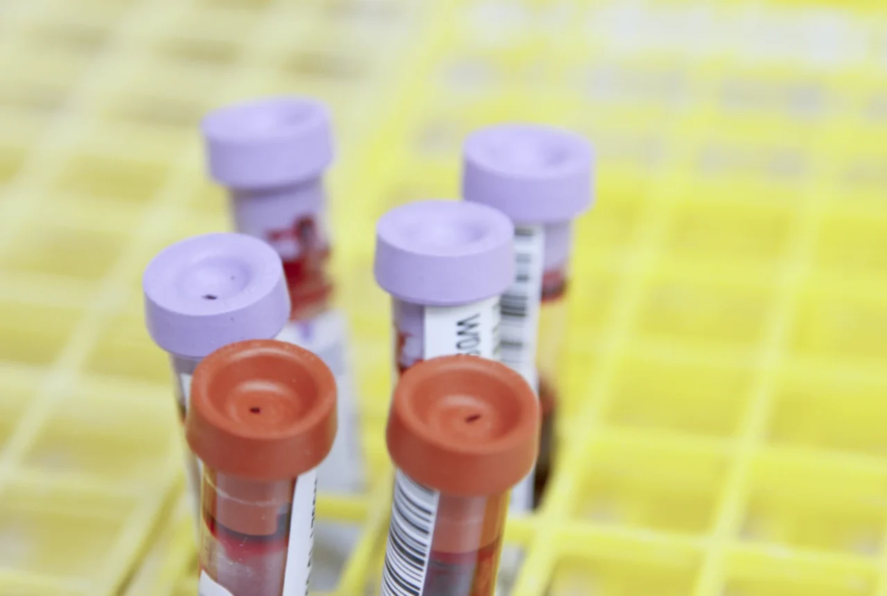 Blood samples in test tubes ready for laboratory screening