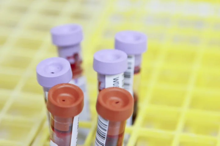 The Hidden Fragility Of Untested Biology