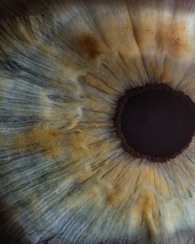 When Floaters In Your Eyes Are Trying To Warn You